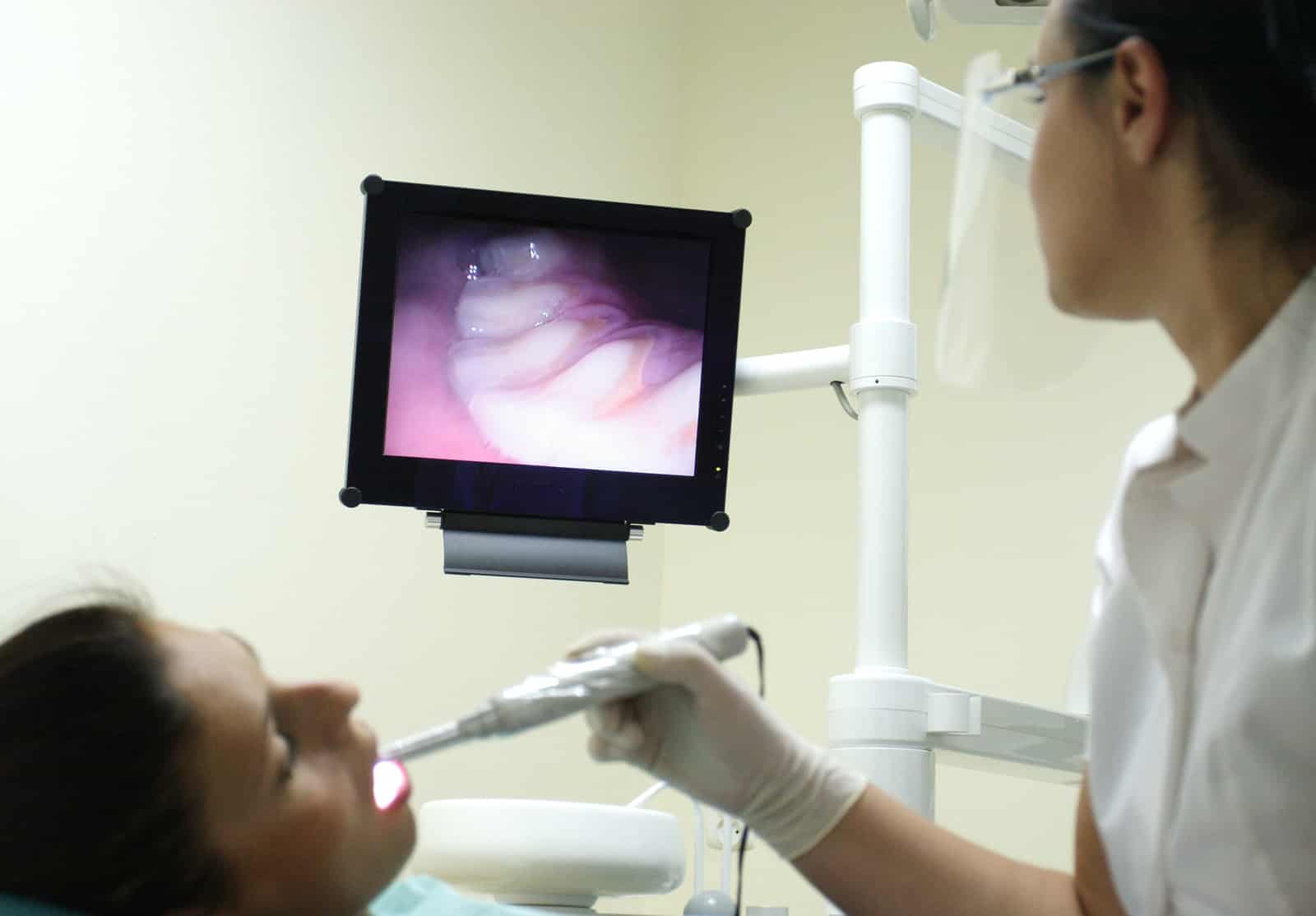 Intraoral Imaging San Diego Dentist in San Diego