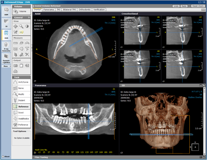 Digital Imaging Software San Diego Dentist in San Diego