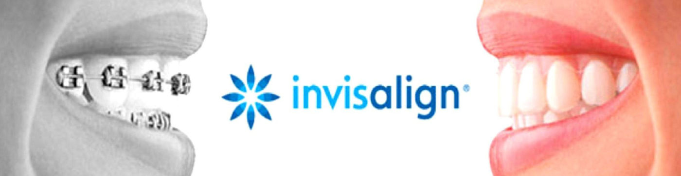 Invisalign San Diego Dentist in San Diego Invisalign San Diego Dentist in San Diego